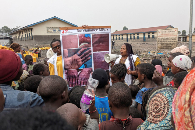 Foto yang disediakan oleh MSF (Doctors Without Borders) tertanggal 31 Mei 2023 ini menunjukkan petugas kesehatan mengedukasi anak-anak mengenai gejala penyakit cacar air di Goma, Kongo. Foto: AP Photo