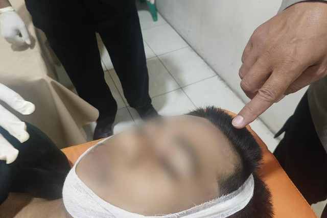 Imam Wahyudi (17) warga Desa Kandung, Kecamatan Winongan, Kabupaten Pasuruan, tewas dianiaya karena geber motor. Foto:  Dok. Polres Pasuruan