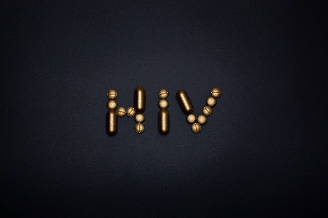 Ilustrasi HIV. Foto: Pixabay