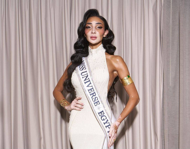 Logina Salah, Miss Universe Mesir 2024 dengan kondisi vitiligo. Foto: Instagram @loginasalah