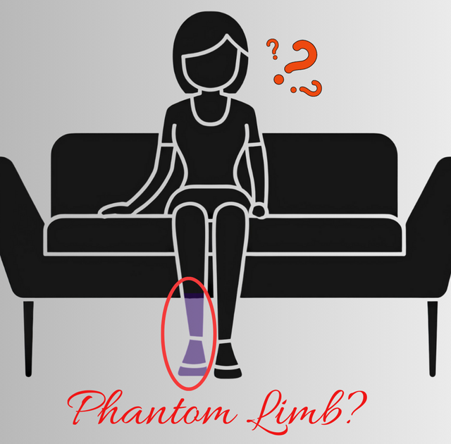 Ilustrasi penderita Phantom Limb Syndrome (canva.com)