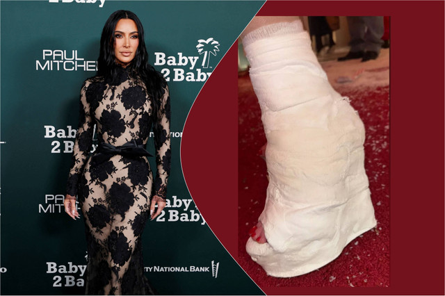 Kim Kardashian pakai sepatu dari gips saat patah kaki. Foto: AFP, Instagram @kimkardasian