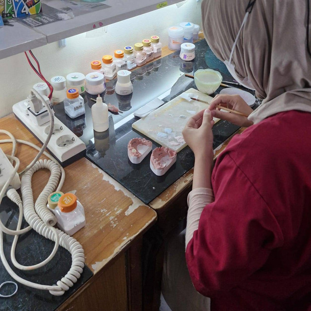 Dokumentasi pribadi ses pembuatan produk hasil Dental Lab