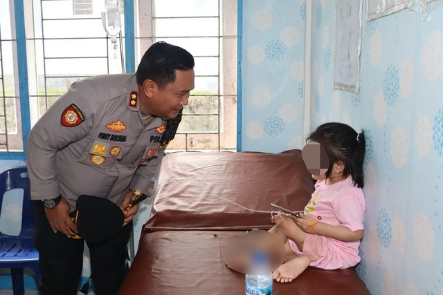 Kapolres Nias Selatan AKBP Ferry Mulyana melihat kondisi anak berusia 10 tahun yang diduga dianiaya keluarganya hingga kakinya bengkok. Foto: Polres Nias Selatan