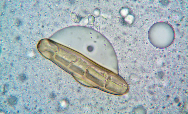 Ilustrasi endospora adalah. Sumber: Pexels/turek