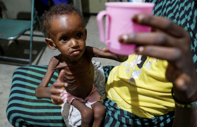 Saddam Najwa, seorang anak pengungsi internal yang kekurangan gizi dan berusia 17 bulan mengulurkan tangan untuk mendapatkan secangkir air di bangsal anak Rumah Sakit Bunda Maria di Gidel, Kordofan Selatan, Sudan. Foto: Thomas Mukoya/Reuters