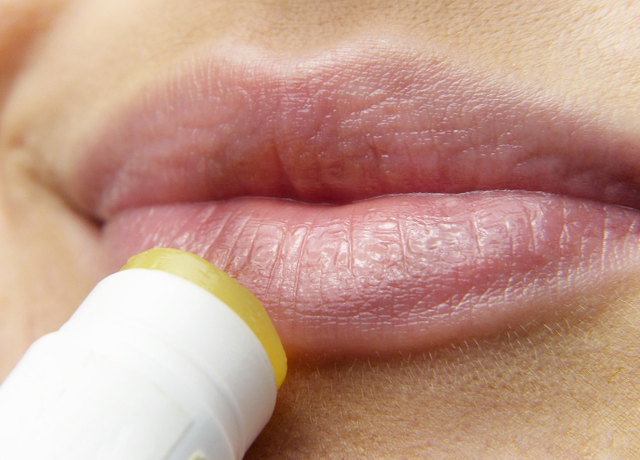 Ilustrasi lip balm untuk bibir hitam dan kering. Sumber foto: Pixabay/ silviarita