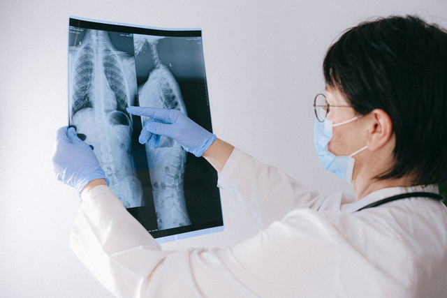 Ilustrasi perbedaan pneumonia dan bronkopneumonia. Foto: Pexels