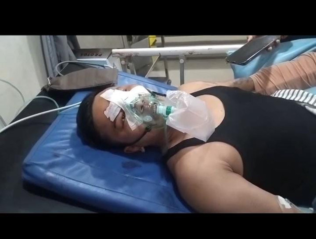 Ahmad (30), korban pembacokan saat lakukan akad pernikahan di Kota Palembang/ist.