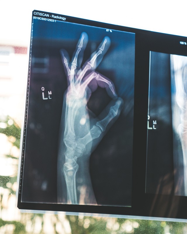 X-Ray, 'Sinar Ajaib' yang Mampu Menembus Tubuh Manusia (7)
