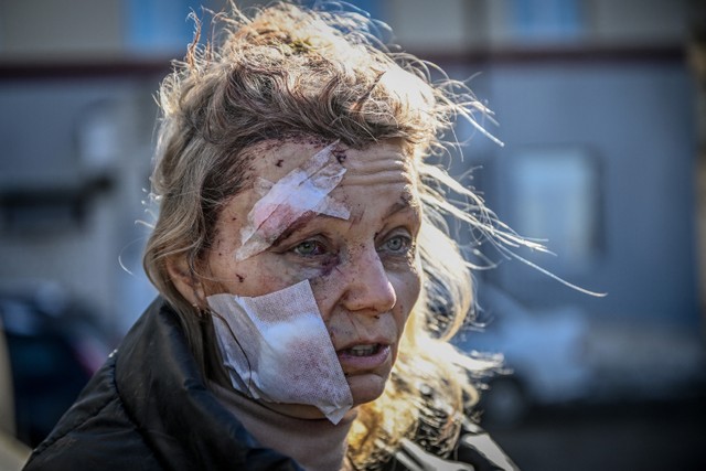 Seorang wanita yang terluka berdiri di luar sebuah rumah sakit setelah pemboman kota Chuguiv di Ukraina timur pada 24 Februari 2022. Foto: Aris Messinis / AFP
