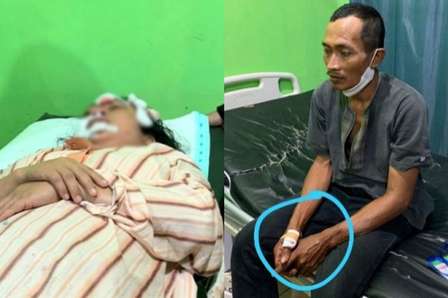 Pasangan suami istri diserang beruang di Pesawaran, Lampung | Foto: Humas Polres Pesawaran