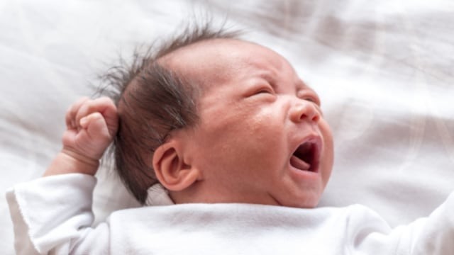 Ilustrasi biang keringat pada bayi. Foto: Shutterstock