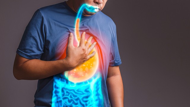 Ilustrasi manusia menderita penyakit asam lambung naik menyebabkan GERD. Foto: Shutterstock