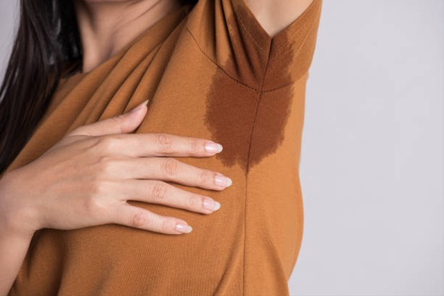 Cara Menghilangkan Fungal Acne pada Kulit dengan Tepat (74003)