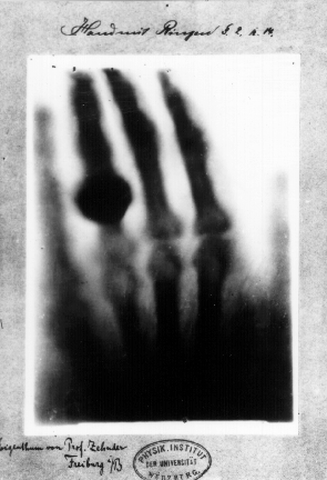X-Ray, 'Sinar Ajaib' yang Mampu Menembus Tubuh Manusia (1)