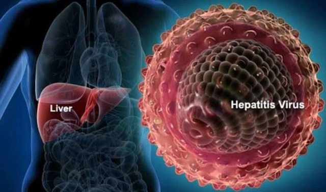 Antisipasi Kejadian Hepatitis Akut pada Anak, IDI Jatim Bentuk Satgas (198819)