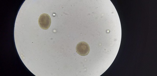 Gambar telur Toxocara sp, hasil Dokumentasi pribadi