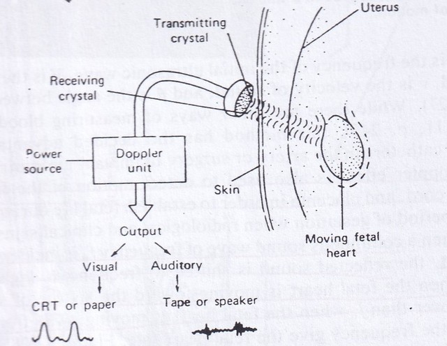 Diagram skematik Fetal Doppler. (Sumber: Cameron, J.R., Skofronick, J.G., Medical Physics, John Wiley and Sons, 1978.)