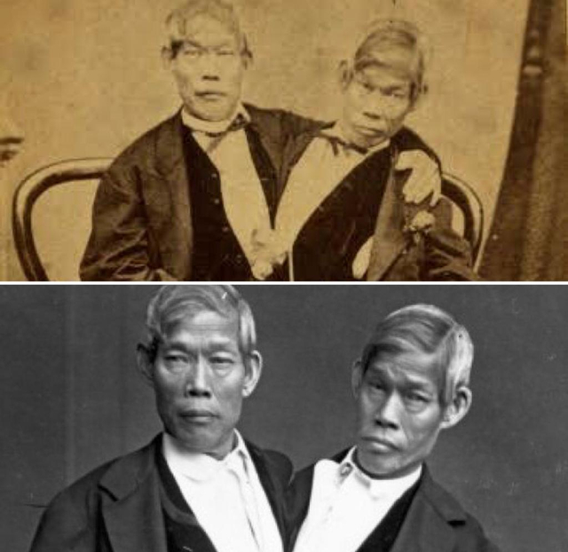 Saudara kembar Chang dan Eng Bunker dari Thailand menjadi awal mula muncul istilah kembar siam. Foto: Istimewa. 