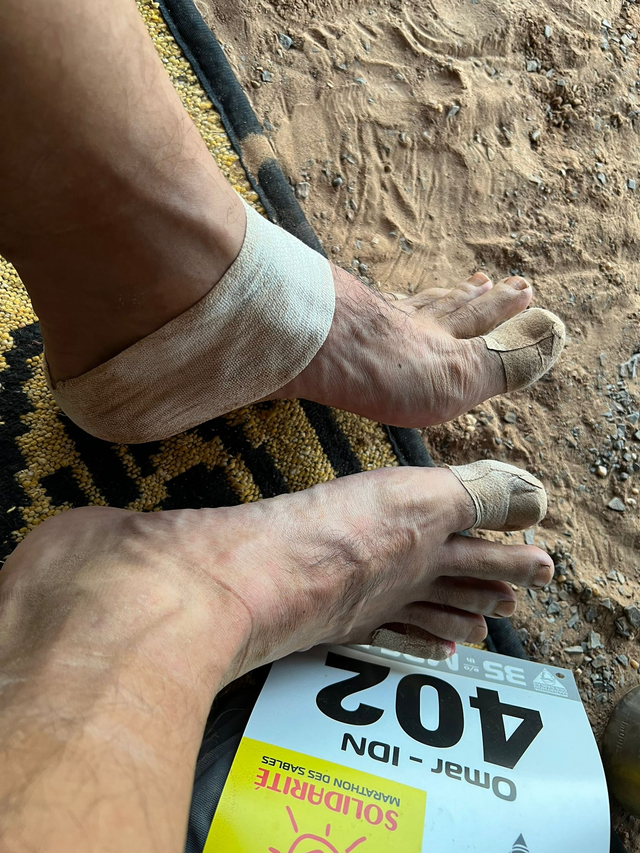 Luka di kaki Omar Agoes di tengah lomba Ultramarathon (Marathon des Sables 2021) lebih dari 250 km di Gurun Sahara, Maroko. Foto: Dok Pribadi Omar Agoes