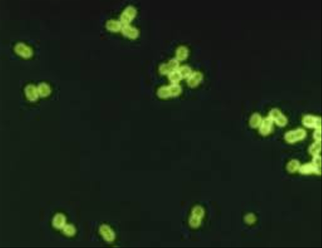 Ilustrasi bakteri diplococcus pneumoniae. Sumber: Wikipedia Commons