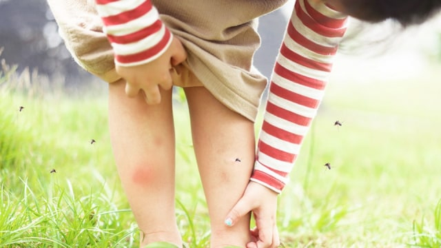 Ilustrasi menggaruk akibat gigitan nyamuk. Foto: Pixabay