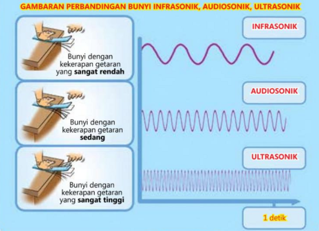 Suara Yang Dapat Didengarkan Oleh Pendengaran Manusia Normal Adalah ...