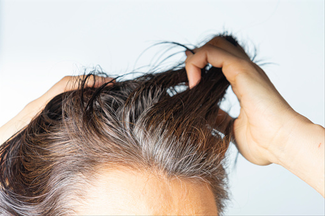 Hukum Mencabut Uban Menurut Islam Simak Kumparan Com