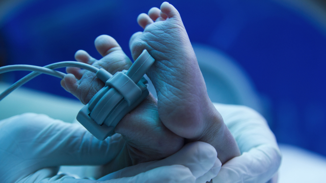 Kaki dan tangan bayi baru lahir berwarna biru. Foto: Shutter Stock