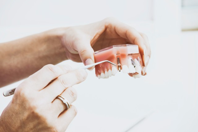 Salah satu penyebab sakit gigi adalah gigi berlubang. Foto: Unsplash