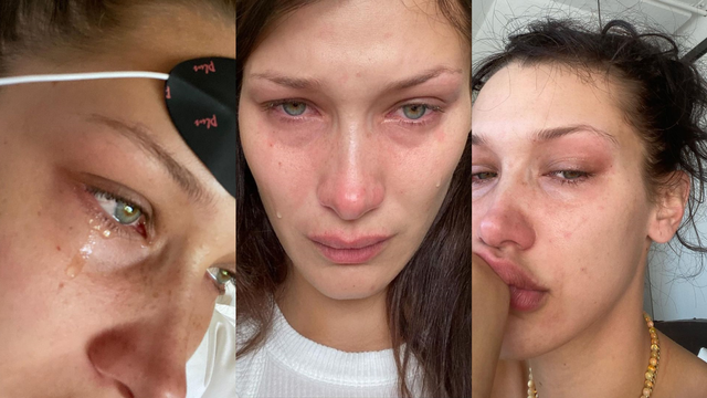 Bella Hadid Akui Sering Merasa Insecure, Sesali Oplas Hidung saat Remaja (178534)