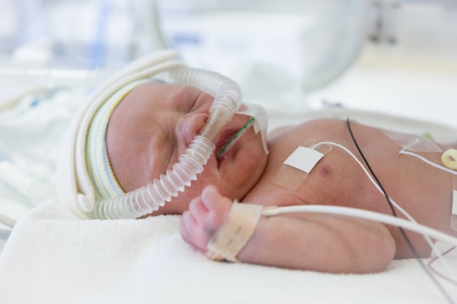 Ilustrasi bayi dengan penyakit jantung bawaan. Foto: Shutterstock