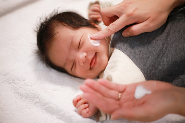 Jenis Ruam Virus yang Bisa Dialami Bayi (83281)