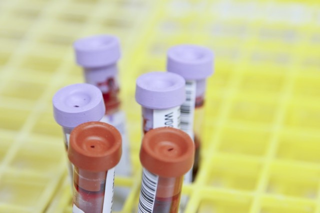  Cara  Mengetahui  Golongan Darah  Bisa Dilakukan di Rumah 