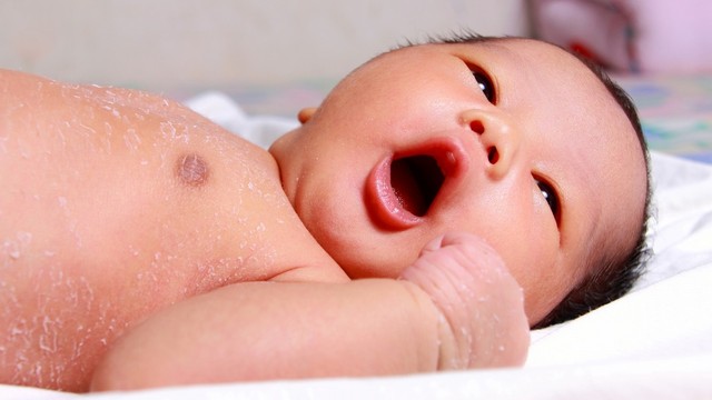 Cara Tepat Rawat Kulit Bayi Baru Lahir yang Mengelupas. Foto: Shutterstock