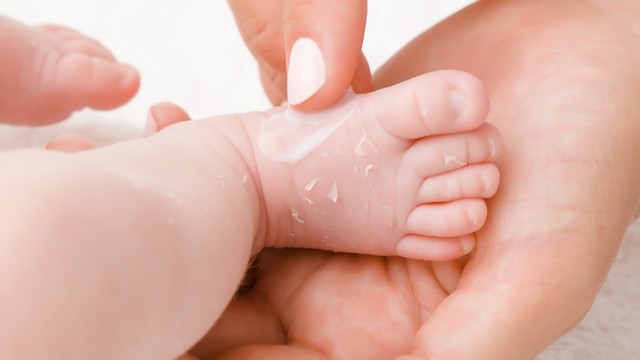 Kulit Bayi Baru Lahir yang Mengelupas, Begini Cara Tepat Merawatnya (38432)