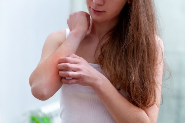 Ilustrasi seseorang mengalami infeksi jamur pada kulit. Foto: Freepik