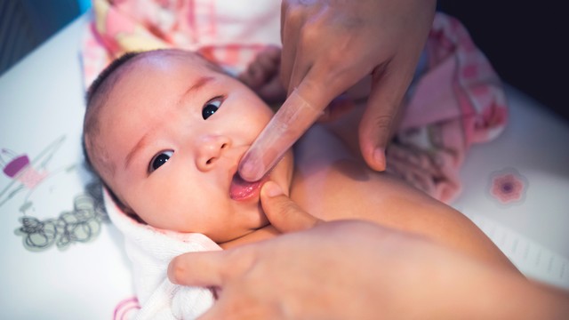 Selain Tumbuh Gigi, Ini Penyebab Gusi Bayi Bengkak. Foto: Shutter Stock