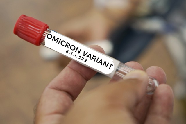 Ilustrasi virus corona Omicron.
 Foto: Shutterstock
