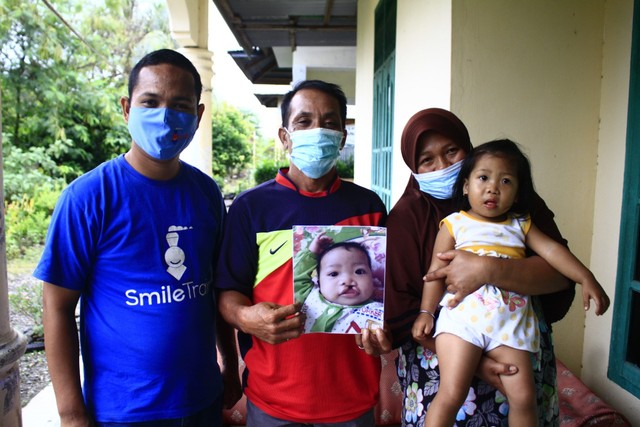 Rahmad Maulizar (kiri) bersama keluarga dengan anak bibir sumbing setelah operasi. Foto: Siti Aisyah/acehkini