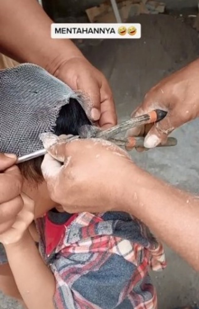 Duh, Kepala Bocah Ini Malah Nyangkut di Saringan Saat Tiru Tokoh di Squid Game (8670)