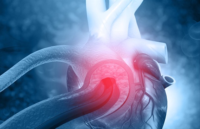 Ilustrasi tekanan darah paling besar terjadi di aorta. Foto: Unsplash.com