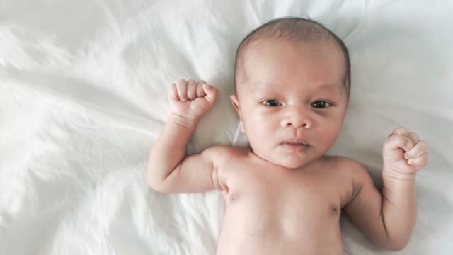 Ciri-ciri Vitiligo pada Bayi (471769)
