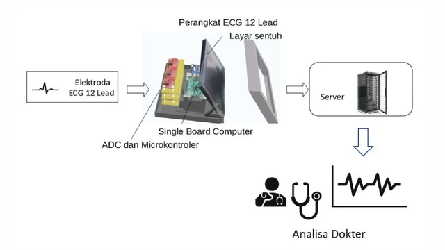 Metodologi sistem ECG 12 Lead secara keseluruhan.