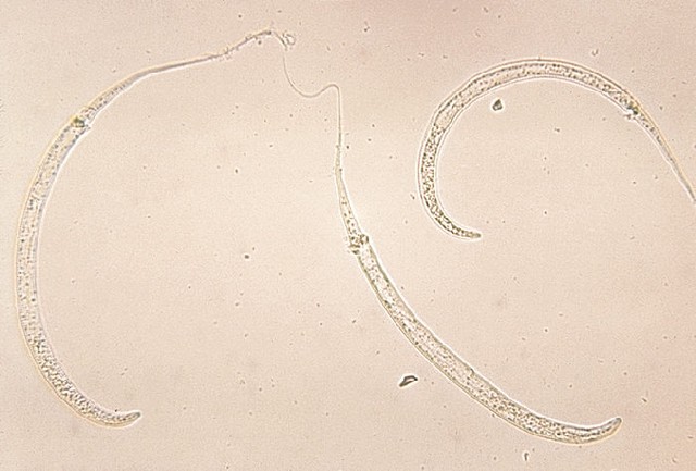 Ilustrasi cacing sebagai parasit dalam tubuh manusia. Foto: Pixabay