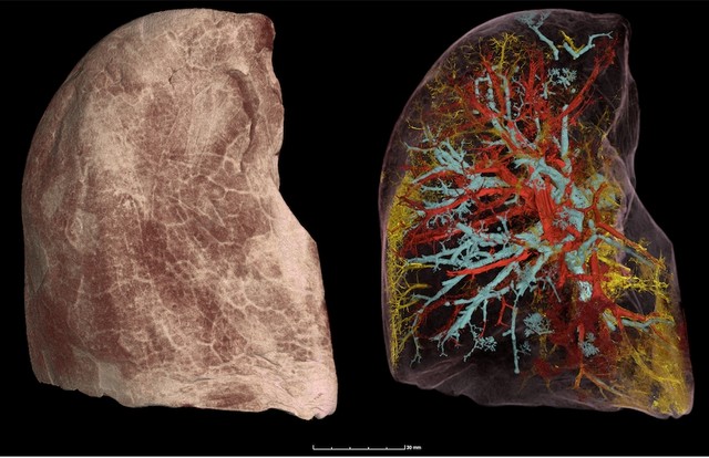 HiP-CT mengungkap citra kerusakan mikroskopis paru-paru penderita COVID-19 yang sebelumnya tidak terdeteksi. Foto: Human Organ Atlas/ESRF. DOI: https://doi.org/10.1038/s41592-021-01317-x