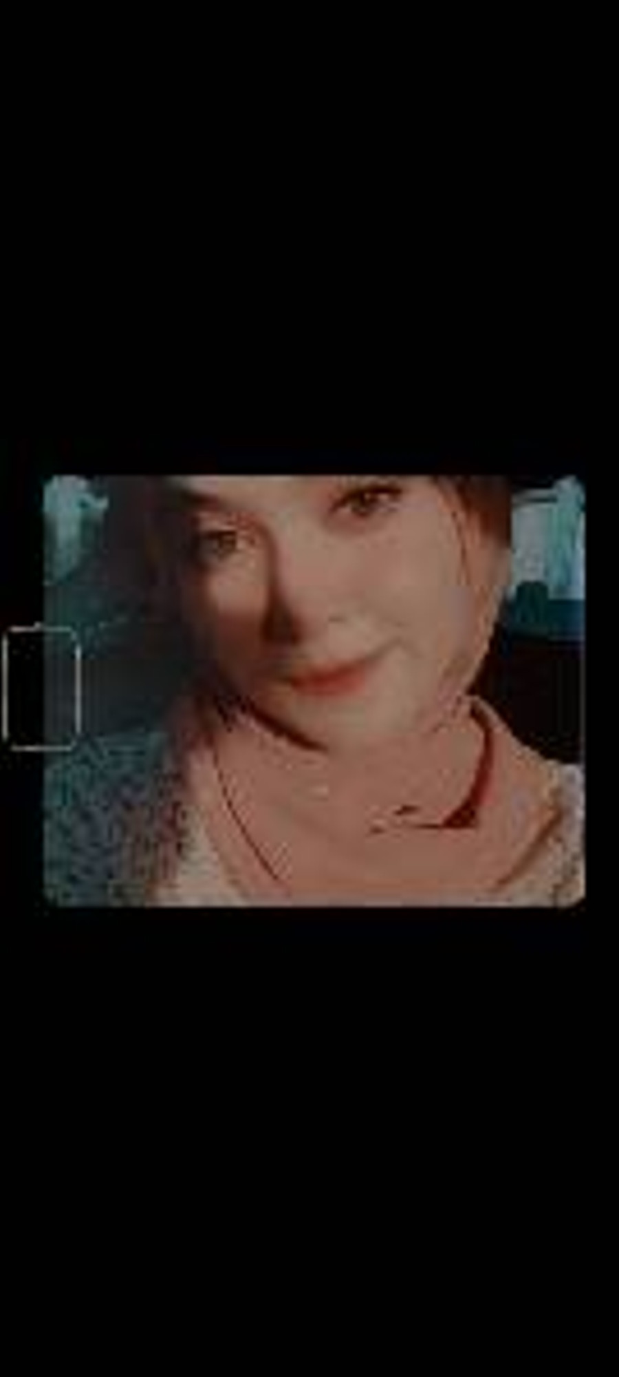 Sindrom Rapunzel: Ketika Rambut Bukan Hanya Kisah Dongeng - kumparan.com