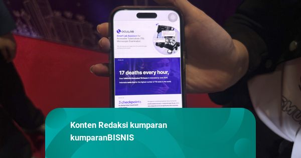 Startup Oculab Buatan Mahasiswa RI Jadi Finalis Kompetisi Global di Singapura