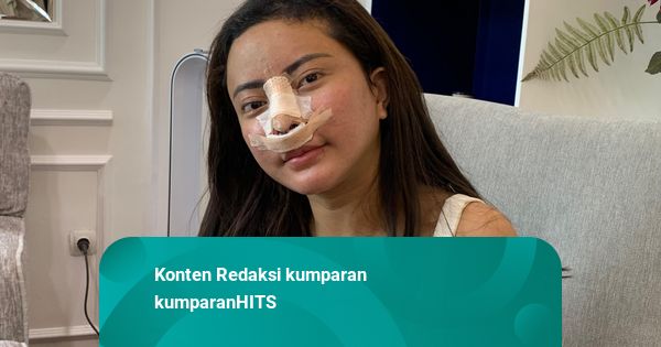 Ayu Aulia Ungkap Sepupunya Diduga Ditipu Lisa Mariana, Rugi Rp 50 Juta